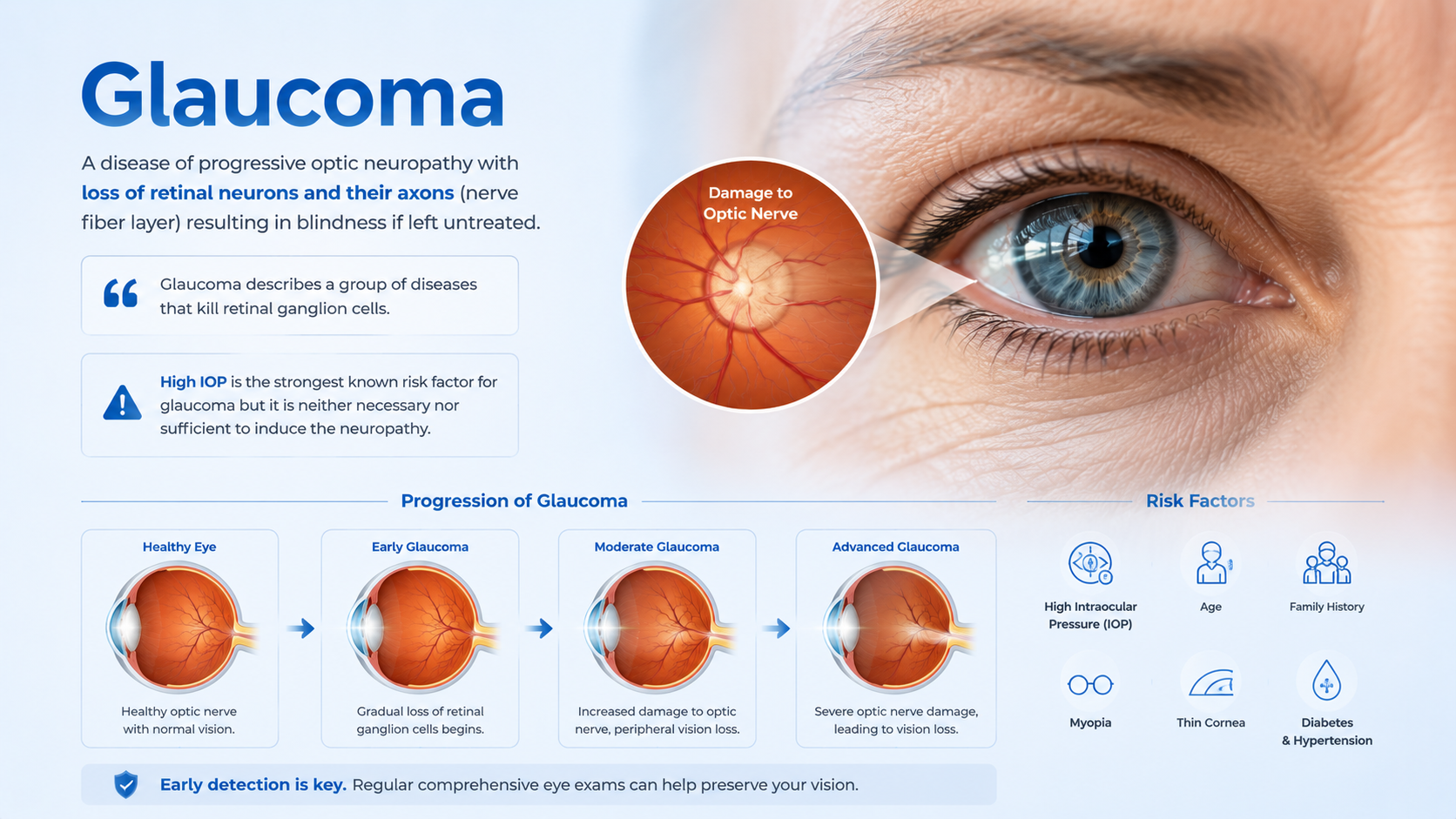 Glaucoma eye care consultation
